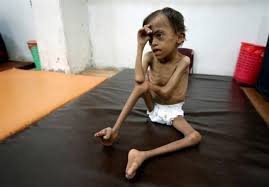 Saudi-skapad hungersnöd